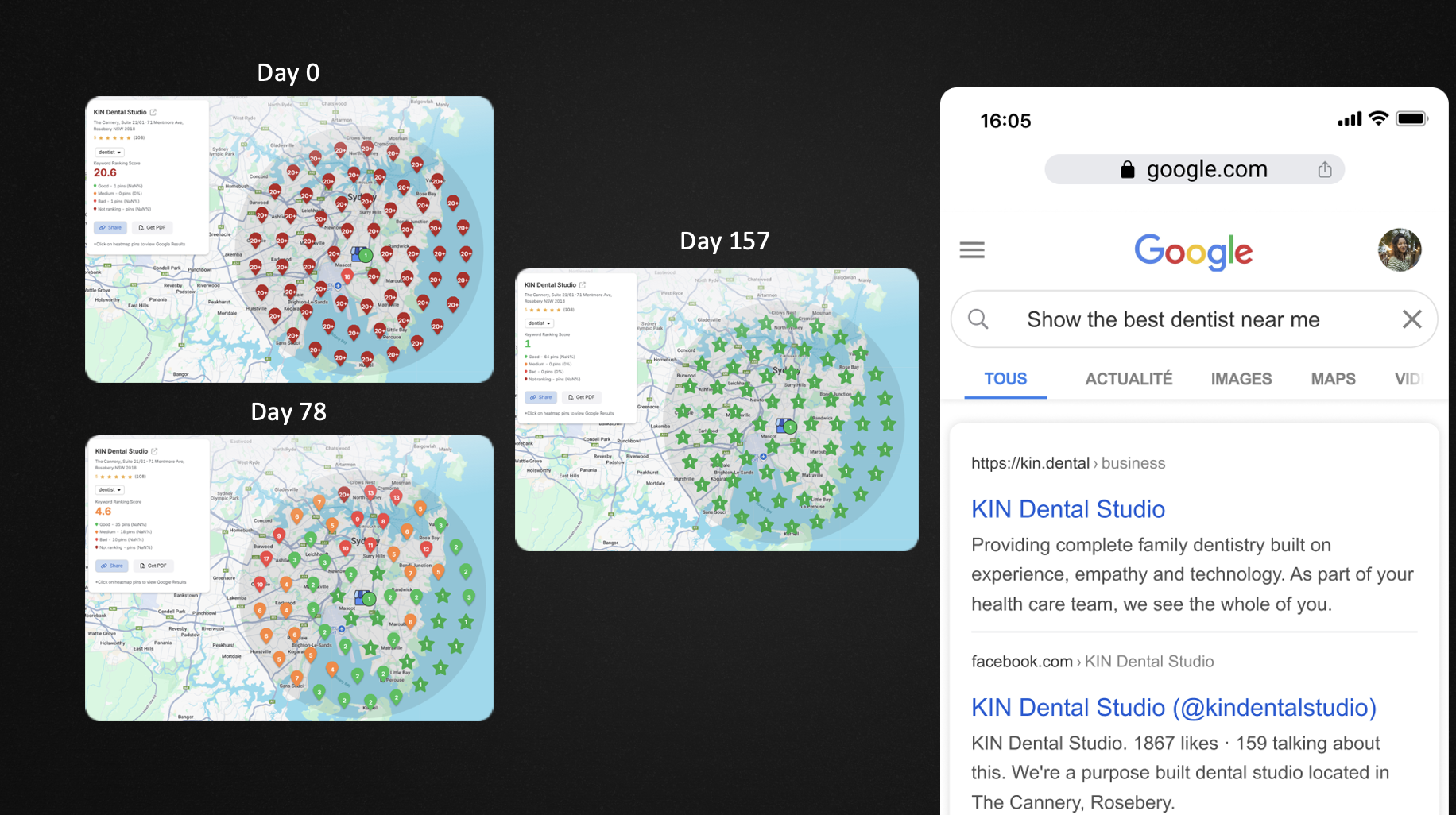 KIN Dental Studio SEO results - Day 0 to Day 157 showing dramatic improvement in Google Maps visibility